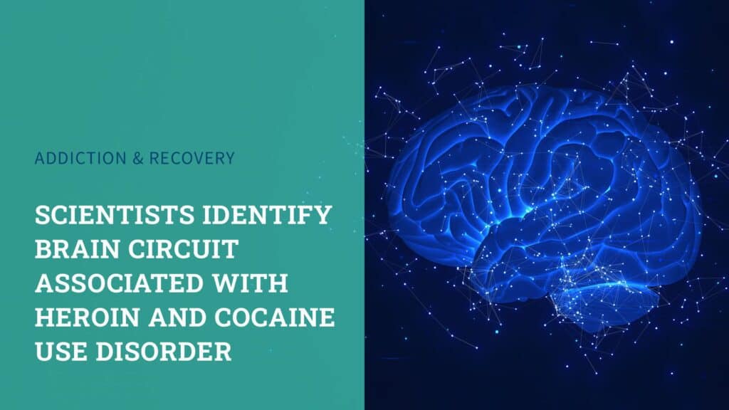 cocaine-heroin_brain