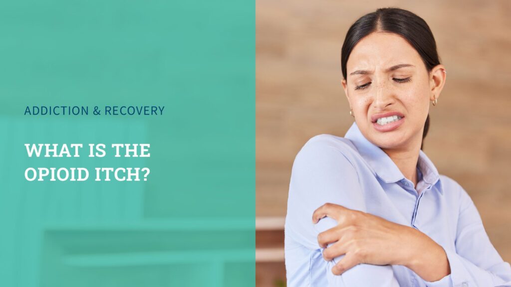 opioid-itch