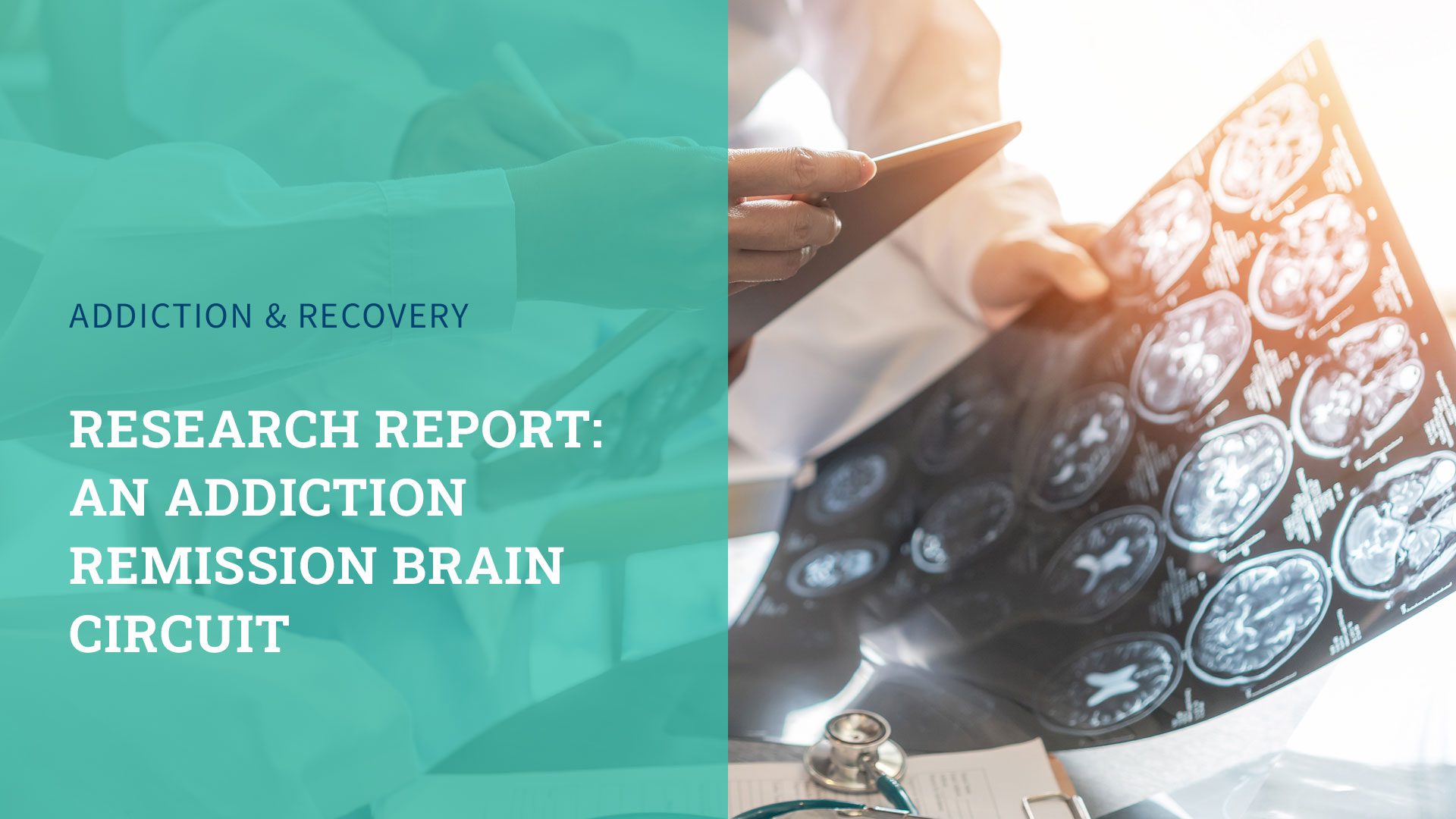 Research Report: An Addiction Remission Brain Circuit